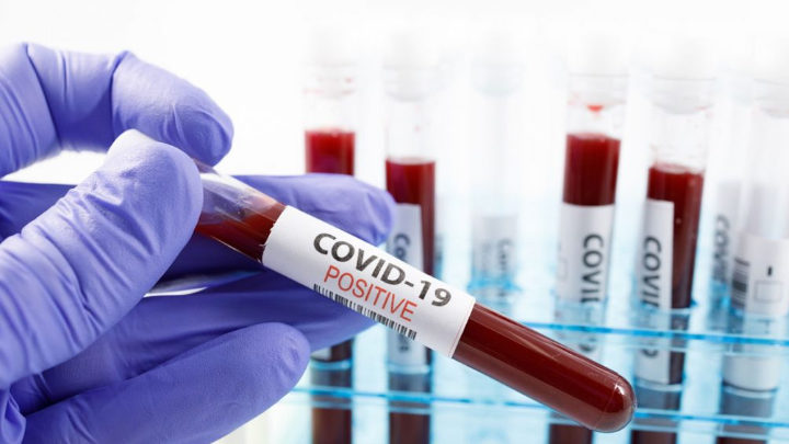 В Ленобласти выявили за сутки 129 новых случаев коронавируса
