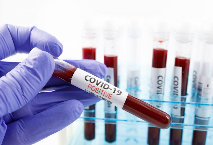 В Ленобласти выявили за сутки 129 новых случаев коронавируса